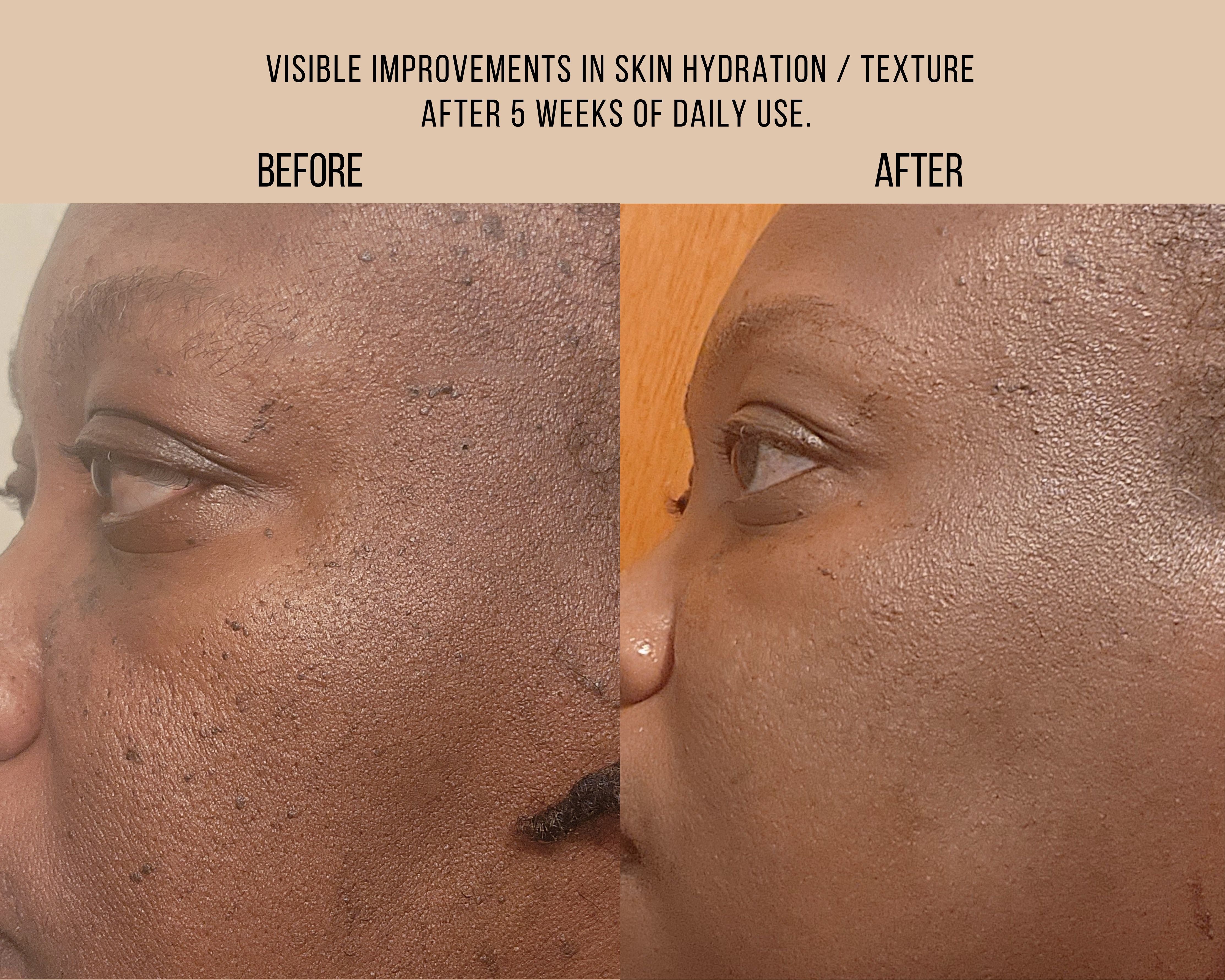 Milk + Tansy - Bi-Phase Essence (3.3 fl.oz)