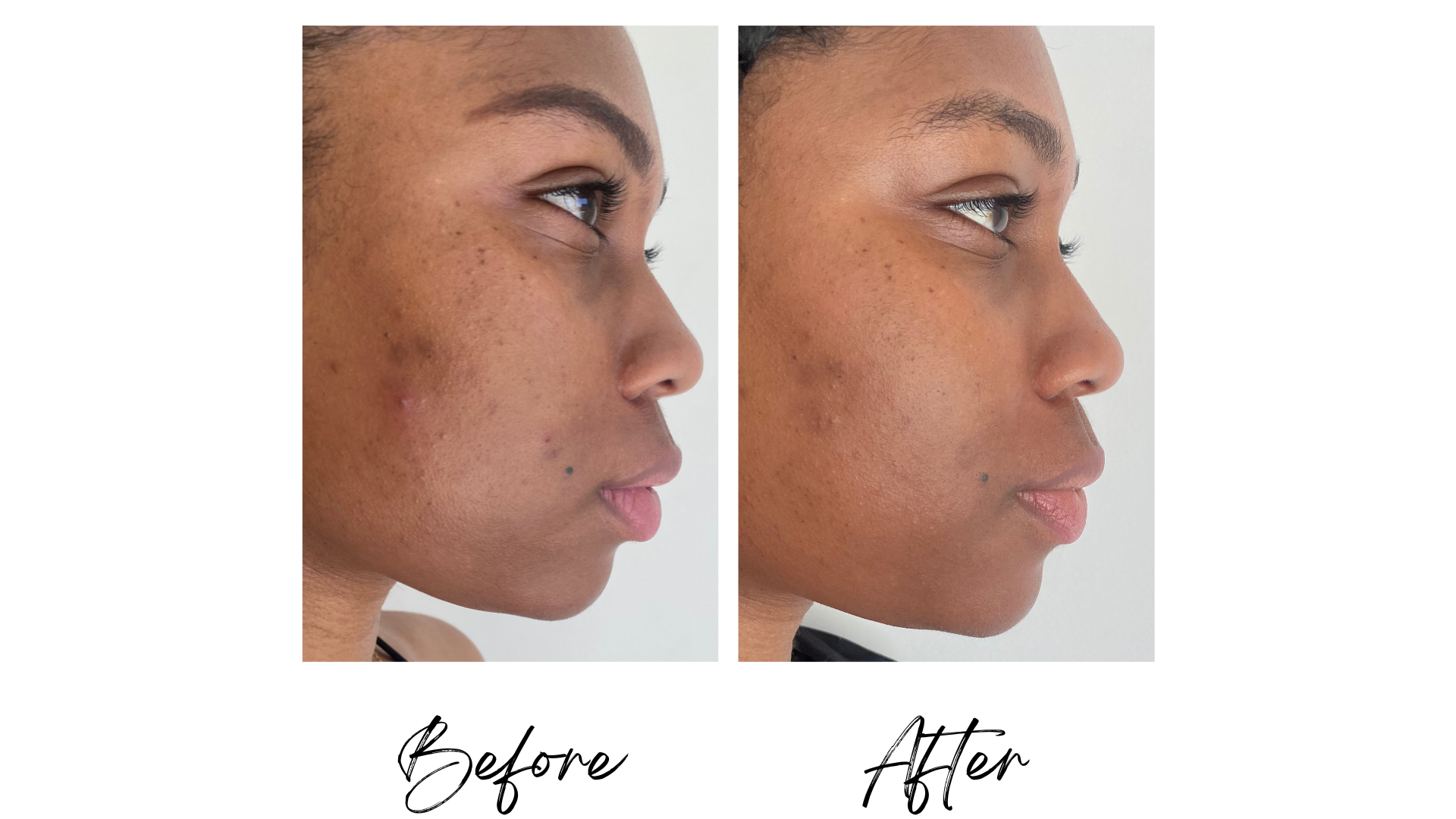 Bright Side - Vitamin C Serum (1oz.)